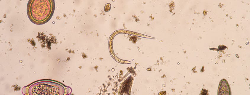 parasites